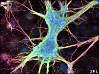 http://newsimg.bbc.co.uk/media/images/44310000/jpg/_44310770_nerve_cell_cred203.jpg